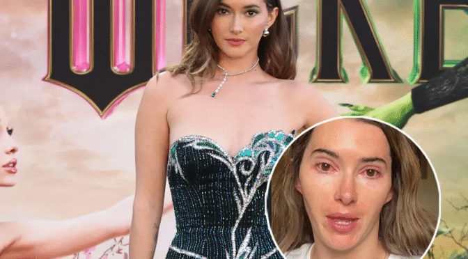 TikTok personality Madeleine White is facing intense criticism after choosing to attend a crowded music festival despite having a clear case of contagious pink eye.